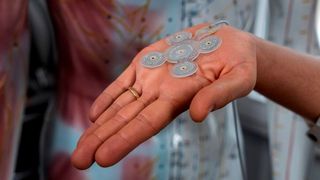 Neuronale Implantante will das Heidelberger Unternehmen Precisis mit Sensorik und KI-basierter Steuerung verknüpfen. Damit sollen künftig Epilepsie präzise erkannt und im besten Fall verhindert werden. (Bild: Precisis)