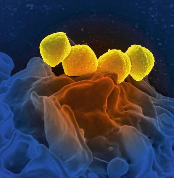 Antibiotika-resistente Bakterien (gelb) können zu schweren, schlecht behandelbaren Wundinfektionen führen. (National Institute of Allergy and Infectious Diseases (NIAID))