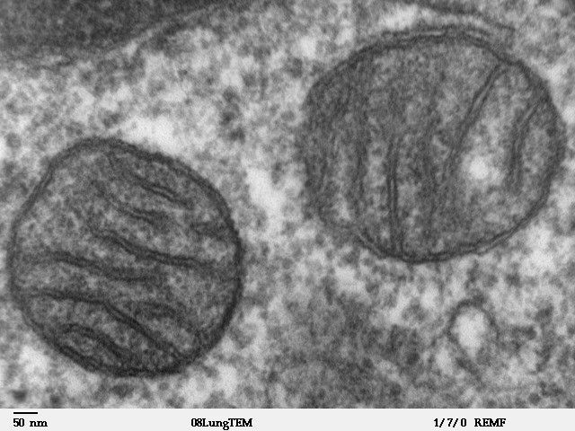 Elektronenmikroskopische Aufnahme von Mitochondrien. (Bild: Wikimedia Commons)