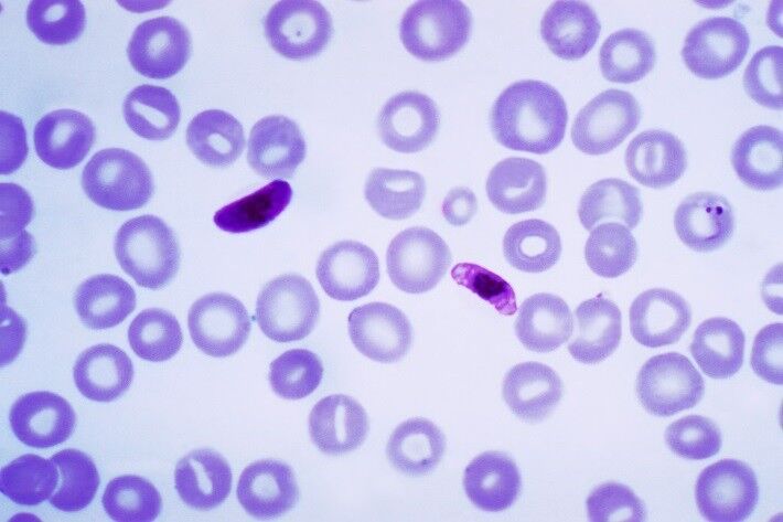 Der Erreger in einem eingefärbten Blutausstrich. Der gefährliche Typ Plasmodium falciparum ist ein einzelliger Organismus, der zunehmend Resistenzen gegen jahrzehntelang bewährte Malariamittel entwickelt. (Foto: commons.wikimedia.org/Dmcdevit (CC BY))