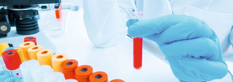 1 Der Einsatz der richtigen Reagenzien ist entscheidend für den Erfolg wissenschaftlicher Experimente. 1 Der Einsatz der richtigen Reagenzien ist entscheidend für den Erfolg wissenschaftlicher Experimente.