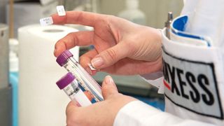 Ab sofort bezieht Lanxess biobasierte Rohstoffe aus pflanzlichen Ölen, um daraus eine neue Serie von nachhaltigen Konservierungsmitteln herzustellen. (Ulla Anne Giesen)