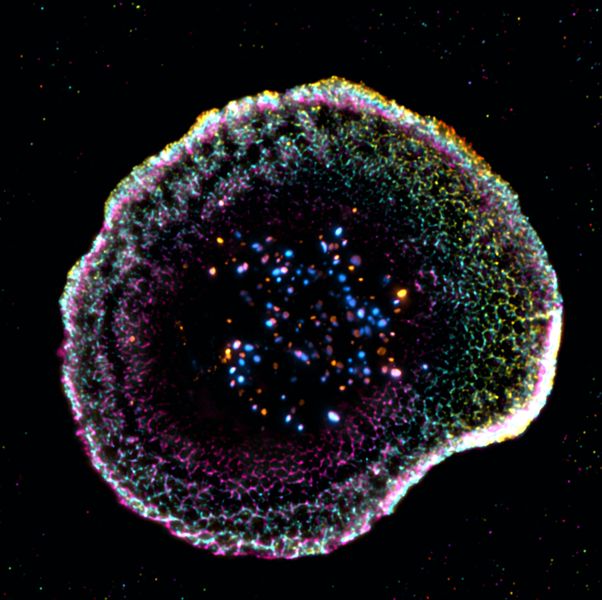 Killerzellen des Immunsystems  Zytotoxische T-Lymphozyten sind die spezialisierten Killerzellen des Körpers. Sie eliminieren gezielt infizierte oder kanzerogene Zellen, ohne benachbarte Zellen zu schädigen. Ihre Wirkung beruht auf einer spezialisierten Austauschzone, wo sie aktive Moleküle freisetzen, um die Zielzelle zu zerstören. Eine Studie der Universität Genf (UNIGE) und des Universitätsspitals Lausanne (CHUV) hat es nun ermöglicht, die Angriffsmechanismen der T-Zellen dreidimensional in einem nahezu nativen Zustand zu visualisieren.     Um die aktiven Strukturen auf der Zelle sichtbar zu machen, nutzten die Forschenden die Kryo-Expansionsmikroskopie (Kryo-ExM). Damit lassen sich biologische Proben so schnell einfrieren, dass das enthaltene Wasser keine scharfkantigen Kristalle, sondern einen glasartigen Zustand bildet, der die Gewebestrukturen nicht zerstört. Die Proben werden dann mithilfe eines absorbierenden Hydrogels physisch expandiert. Das ermöglicht es, ihre innere Organisation mit großer Präzision zu beobachten und dabei ihre nahezu native Architektur zu erhalten. Mit den Ergebnissen eröffnen sich neue Perspektiven in der Immunonkologie.  Das Bild zeigt eine zytotoxische T-Zelle, aufgenommen mit Kryo-ExM. Die farbigen Punkte im Zentrum sind zytotoxische Granula, die genutzt werden, um infizierte oder krebsartige Zellen zu zerstören.    Hier geht’s zur Originalmeldung Wissenschaftsbild des Tages vom 5.5.2026  (Bild: F. Lemaitre, UNIGE)