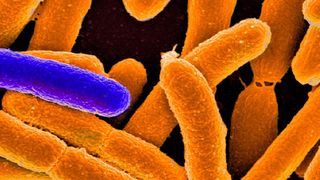 Manche Bakterien überdauern Antibiotikabehandlungen in einer Art Winterschlaf. (Beispielbild: Elektronenmikroskopie-Aufnahme von Escherichia coli; eingefärbt) (National Institute of Allergy and Infectious Diseases)