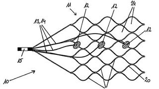 Eine Hörprothese und Verfahren zur Herstellung einer derartigen Hörprothese. (Bild: DPMA)