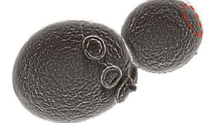 Elektronenmikroskopische Aufnahme einer knospenden Hefezelle. Die rot gestrichelte Markierung auf der Knospe deutet die intrazelluläre Verteilung des Polarsioms an. Bei den „angenähten Knöpfen“ handelt es sich um Narben auf der Zellwand der Mutterzelle, an denen frühere Knospen bereits abgetrennt wurden. (Bild: Arbeitsgruppe Johnsson, Dr. J. Chollet / Uni Ulm))