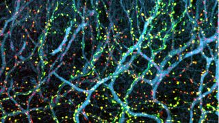 Synaptischen Verbindungen im Gehirn eines Autismus-Modells (Bild: Stephane Baudouin)