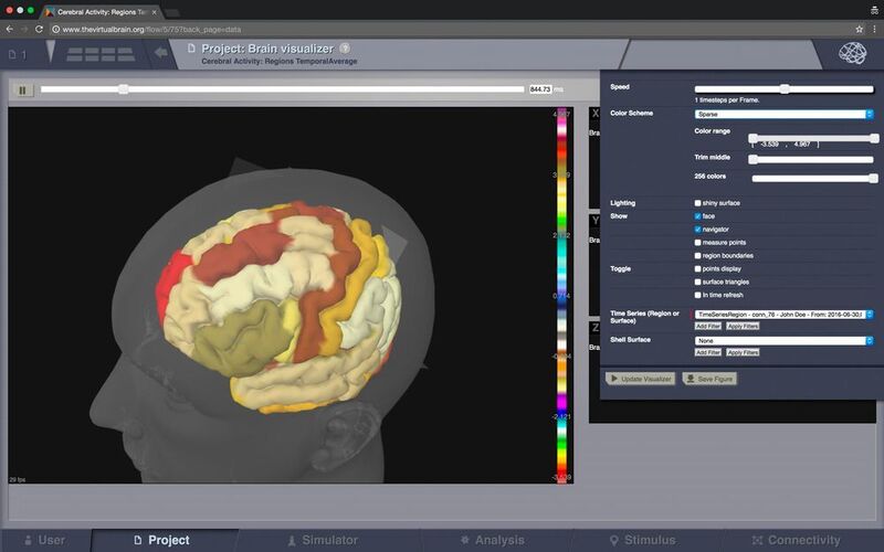 Die Virtual-Brain-Software im Einsatz (The Virtual Brain)