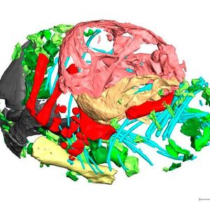 3D reconstruction of the skeleton(Source:  Professor Julien Benoit)