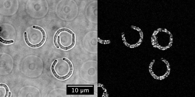 Stressed-out E.coli recovers its straight, rod-like shape over time. (Lars D. Renner at the Leibniz Institute of Polymer Research and the Max Bergmann Center of Biomaterials, Dresden, Germany)