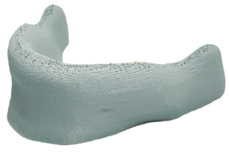 Ein gedrucktes Unterkiefer-Modell von Envision TEC aus Kunststoff. Das echte Implantat entsteht später aus Keramik. (Bild: Envision-TEC)