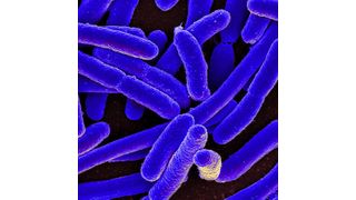 Colorized scanning electron micrograph of Escherichia coli, grown in culture and adhered to a cover slip. (NIH)