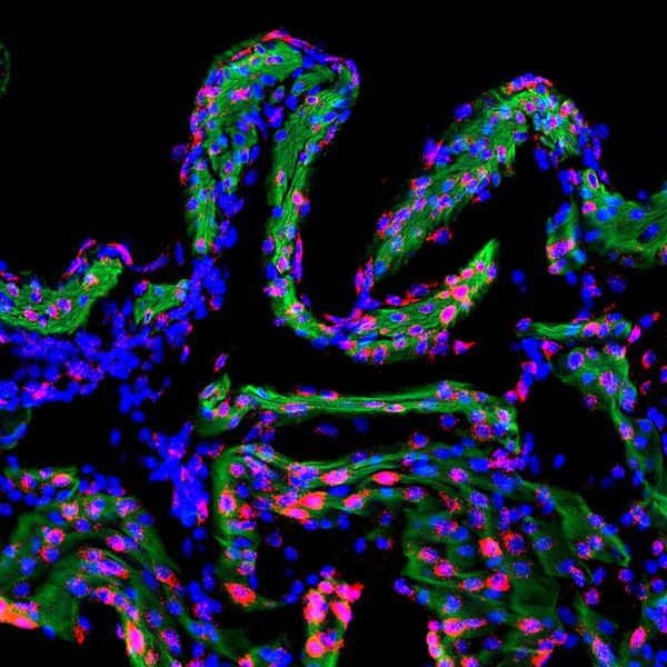 Das Geheimnis rund um Wehen  Eine Studie von Scripps Research zeigt, dass zwei „Kraftsensoren“ namens PIEZO1 und PIEZO2 die Wehen steuern. PIEZO1 sitzt in der Gebärmuttermuskulatur und spürt den Druck einer Wehe, PIEZO2 liegt in Nerven von Muttermund und Scheide und reagiert auf Dehnung durch das Baby; zusammen geben sie Signale, damit die Muskulatur im Rhythmus und im Team arbeitet.  In Mausversuchen, bei denen diese Sensoren gezielt ausgeschaltet wurden, waren die Wehen schwächer und die Geburt verzögert; außerdem sank ein Verbindungsprotein (Connexin 43), das die Muskelzellen koordiniert. Menschliches Gewebe zeigte ähnliche Muster. Das erklärt, warum eine sehr starke Nervenbetäubung die Geburt verlangsamen kann. Langfristig könnten Medikamente, die PIEZO-Signale dämpfen oder verstärken, Wehen bei Frühgeburt bremsen oder bei Geburtsstillstand anregen – im Zusammenspiel mit Hormonen wie Progesteron.  Auf dem Bild zu sehen sind Gja1-Transkripte in der Gebärmuttermuskulatur der Maus gegen Ende der Schwangerschaft (Trächtigkeitstag 18,5). Gja1 kodiert für Connexin 43, ein Protein, dessen Menge in dieser Phase zunimmt und das die Koordination der Uteruskontraktionen unterstützt. Grün zeigt glatte Muskelfasern der Gebärmutter, Rot markiert Gja1 mRNA, und Blau zeigt Zellkerne.  Hier gehts zur OriginalmeldungWissenschaftsbild des Tages vom 18.11.2025  (Bild: Scripps Research)