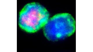 T-Zellen unter Kontrollbedingungen. Immunfluoreszenzfärbung von T-Zellen (grün: T-Zellmarker CD3, rot: Treg-Marker Foxp3, blau: Zellkern) (Ausschnitt) ... (Helmholtz Zentrum München)
