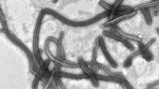 Mikroskopaufnahme von Ebola-Viren  (Philipps-Universität Marburg)