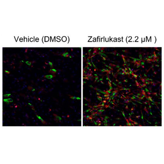 Zafirlukast induces the production of brown adipocyte tissue. For preadipocytes treated with zafirlukast (right image), brown adipocytes (shown in red) were much more prevalent than preadipocytes grown with the DMSO control (left image). Zafirlukast induces the production of brown adipocyte tissue. For preadipocytes treated with zafirlukast (right image), brown adipocytes (shown in red) were much more prevalent than preadipocytes grown with the DMSO control (left image).
