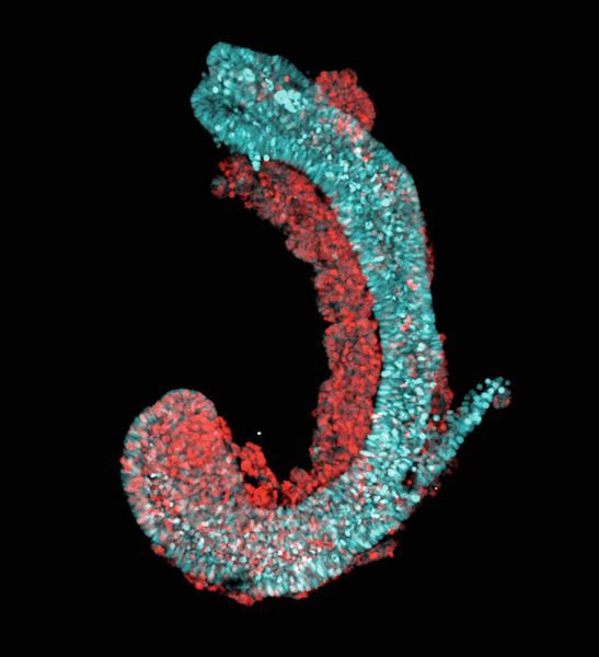  Fluoreszenz-mikroskopische Aufnahme einer 