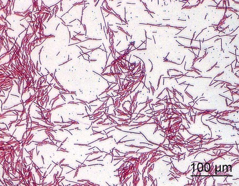 Lichtmikroskopische Aufnahme von Clostridium ramosum nach Gram-Färbung (Tina Jaenicke/DIfE)