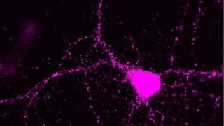 Fluoreszenzbild einer Nervenzelle aus dem Hippocampus. In Magenta ist das aktivierte intrazelluläre Adapterprotein Dab1des Reelin-Signalweges dargestellt, das für die Gehirnreifung entscheidend ist. ((c) Arbeitsgruppe Amparo Acker-Palmer)