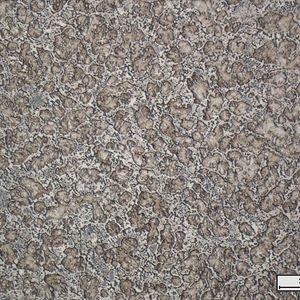 Die eisenbasierten Werkstoffe Rockit 606 und Rockit 706 weisen eine martensitische Struktur mit fein verteilten Vanadiumkarbiden auf.