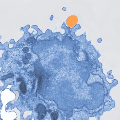 Image au microscope électronique pseudocolorée d'un macrophage (en bleu) absorbant des microplastiques (en orange). (Bild: Mass Lab/Université de Bonn)