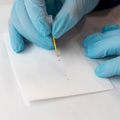 McMaster University's new Salmonella test indicates the presence of Salmonella by producing a red dot on test paper. McMaster University's new Salmonella test indicates the presence of Salmonella by producing a red dot on test paper.