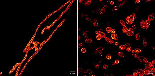 Inner membranes of live mitochondria under a Sted microscope usinig the MitoPB yellow fluorescent marker molecule created by researchers at the Institute of Transformative Bio-Molecules (ITbM) at Nagoya University. (Nagoya University)