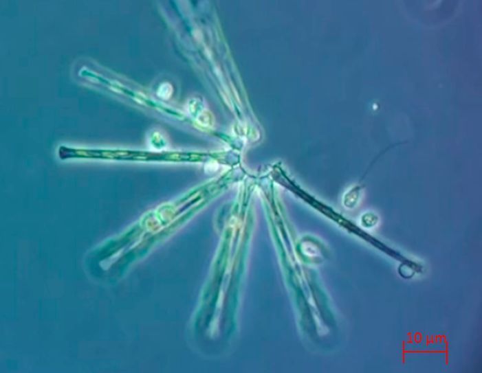 Abb. 3: Anhand der gefundenen Flagellatengruppen können Rückschlüsse auf die Elimination von pathogenen Keimen getroffen werden. (Universität zu Köln)