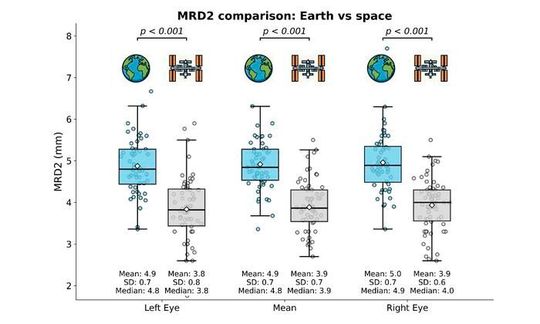  Comparison of terrestrial and spaceflight MRD2 value(Source:  Higher Education Press)