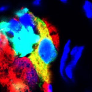 Pancreas Cells Can Change Identity to Produce Insulin