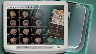 Neue Diagnosemethoden wie 4-D-Untersuchungen bieten Mediziner detaillierte Einblicke in den Körper, setzen jedoch leistungsstarke PC-Technologie voraus (Archiv: Vogel Business Media)