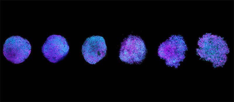 Proteinüberschuss gefährdet die Zelle   Es ist ein empfindliches Gleichgewicht: Zellen müssen von jedem Protein die richtige Menge produzieren. Sowohl Mangel als auch Überschuss können essenzielle Zellfunktionen beeinträchtigen. Forschende der Universität Genf haben nun gezeigt, dass ein Überschuss von Tubulin – dem Protein, das die Mikrotubuli bildet, das innere Gerüst der Zelle – ausreicht, um die Gewebearchitektur zu zerstören.   Die Forschenden untersuchten Sphäroide mit Zellen, die zehn bis zwanzig Prozent mehr Tubulin als normal produzierten. „Man könnte erwarten, dass mehr von diesem Protein das Zytoskelett stärkt. Das Gegenteil ist der Fall“, sagt Ana Coelho de Almeida, Postdoktorandin in Gasics Labor und Erstautorin der Studie.  Die Effekte greifen schnell über einzelne Zellen hinaus. Proteine, die für Zell-Zell-Kontakte zuständig sind, werden falsch positioniert. Zellkontakte schwächen ab, die Gewebearchitektur verschlechtert sich, die Zelllebensfähigkeit sinkt.    Hier geht‘s zur Originalmeldung Wissenschaftsbild des Tages vom 6.8.2026  (Bild: Ana Coelho Almeida, Gasic Lab, UNIGE)