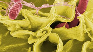 Im Jahr 2010 wurden im Zoonosen-Monitoring 8.180 Proben aus Erzeugerbetrieben, Schlachthöfen und dem Einzelhandel auf Erreger wie Salmonella spp. (im Bild Sekundärelektronenmikroskopaufnahme), Campylobacter spp., verotoxinbildende E. coli oder ähnliche untersucht.  (Bild: Rocky Mountain Laboratories, NIAID, NIH)