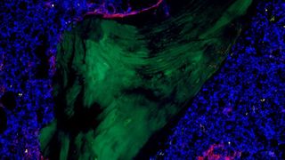 Das Foto zeigt menschliches Knochenmark, den natürlichen Aufenthaltsort für hämatopoietische Stammzellen. grün: Knochen, blau: Zellkerne von Knochenmarkszellen, rot: umgebende Bindegewebszellen. (BIH / R. Lutz & S. Haas)