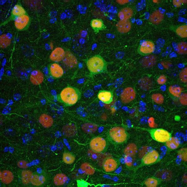  Angst: Ein Ungleichgewicht im Gehirn  Eine spezielle Gruppe von Neuronen in der Amygdala spielen eine entscheidende Rolle bei der Entstehung von Angstzuständen und sozialen Störungen. Dies fanden Forscher der Universidad Miguel Hernández de Elche heraus. Wenn diese spezielle Gruppe von Neuronen aus dem Gleichgewicht gerät, kann sie pathologisches Verhalten auslösen.  Durch genetische Modifikationen gelang es den Wissenschaftlern, die Genexpression in der basolateralen Amygdala zu normalisieren. Eine gezielte Korrektur dieser neuronalen Schaltkreise könnte somit neue therapeutische Wege eröffnen, um affektiver Störungen zu behandeln.   Diese Entdeckung könnte neue Ansätze für zukünftige Behandlungen darstellen, weil sie ein tieferes Verständnis der neuronalen Mechanismen bietet, die Angstzustände und soziale Störungen verursachen. Durch die Identifizierung spezifischer Neuronengruppen in der Amygdala und das Verständnis, wie deren dysfunktionale Aktivität pathologisches Verhalten hervorruft, können gezieltere und effektivere Therapien entwickelt werden.   Hier gehts zur Originalmeldung Wissenschaftsbild des Tages vom 10.7.2025 Bildquelle: Instituto de Neurociencias UMH CSIC:  Ein konfokales Mikroskopie-Bild zeigt Zellen der basolateralen Amygdala, die mit einem Virus infiziert sind, das so konstruiert wurde, dass es das CRE-Rekombinase-Protein (in Rot) und das fluoreszierende Protein GFP (in Grün) einführt, was die Visualisierung der Infektion ermöglicht., (CC BY)   (Bild: Instituto de Neurociencias UMH CSIC)