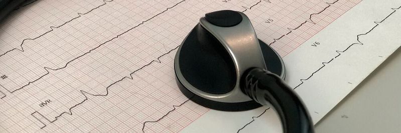Maschinen-EKG: Sensorik und KI sollen dabei helfen, den Zustand einer Komponente und damit ihre Restlebensdauer realistisch abzuschätzen.(Bild:  gemeinfrei /  Pixabay)