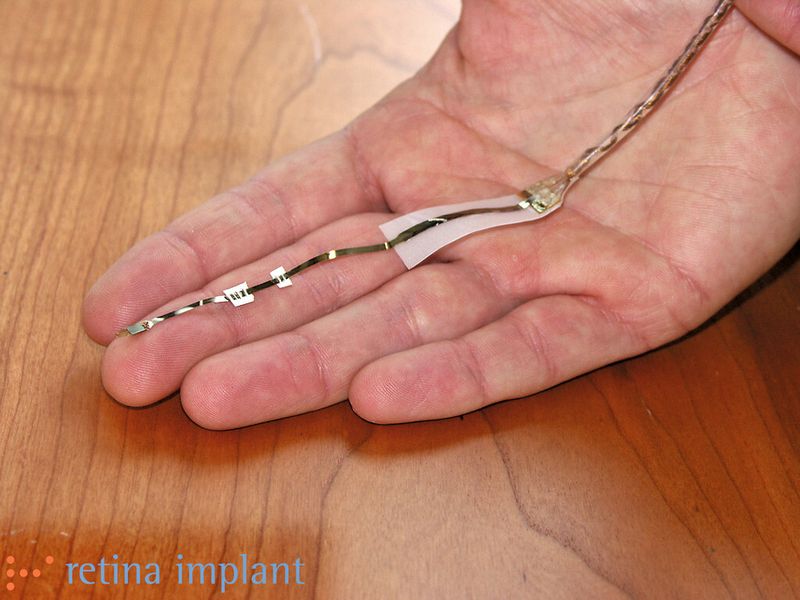 Retina-Implant: Für diesen Netzhaut-Chip, mit dem sich Sehleistungen wiederherstellen lassen, fertigte die Entwicklungswerkstatt unter anderem die Halterungen, zur Herstellung des Chips. (Bild: Retina Implant)