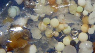 Probe aus dem Rhein bei Duisburg mit über 65% opaken Mikroplastikkügelchen in 15-facher Vergrösserung; der Durchmesser der Kügelchen beträgt 0,4–0,9 Millimeter. (Foto: Universität Basel, Thomas Mani)