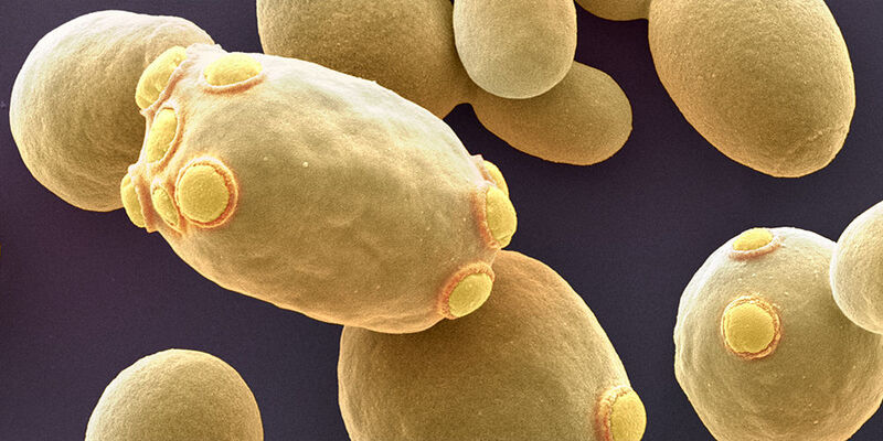 Die Bäckerhefe Saccharomyces cerevisiae.  (Universität Basel/SNI/Nano Imaging Lab)