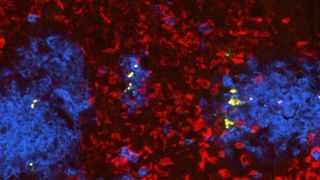 Schnitt durch eine mit Salmonellen (gelb) infizierte Milz (Rot: rote Blutkörperchen; Blau: Neutrophile). (Bild: Universität Basel, Biozentrum)