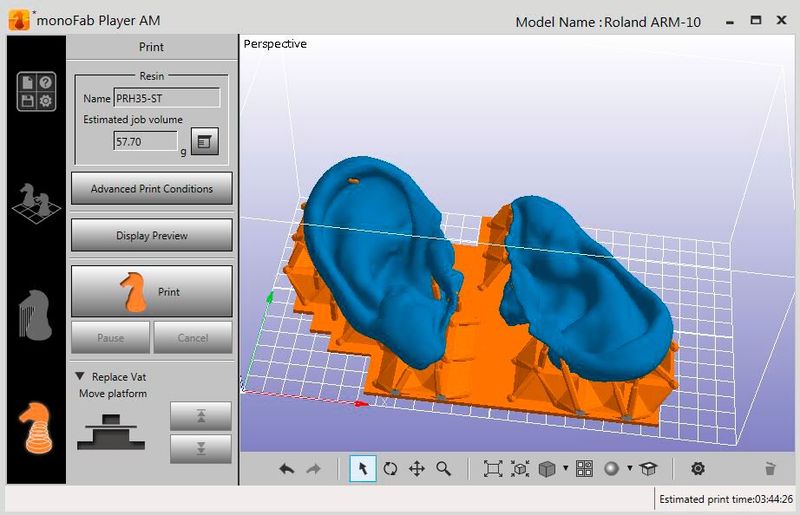 Der 3-D-Scanner erfasst zuerst die Ohrmuschel und arbeitet sich dann zum Sammeln weiterer visueller Informationen tief in den Gehörgang vor. (Bild: Artec 3D)