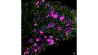 Mouse neurons with the new ion channel Elkin1 (cyan), which is responsible for touch sensation, nucleus (yellow) and the already known ion channel Piezo2 (magenta). (Source: Sampurna Chakrabarti, Max Delbrück Center)