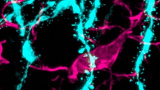 Ein verstärkter Abbau dendritischer Dornfortsätze von Nervenzellen (türkis) durch spinnenförmige Mikrogliazellen (pink) lässt sich im Gehirn männlicher Mäuse nach Immunstimulation beobachten. (Bild: Universitätsklinikum Freiburg)