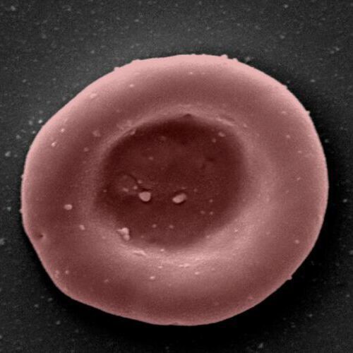 Microscope image: Example of a Restore laboratory grown young red blood cell. Microscope image: Example of a Restore laboratory grown young red blood cell.