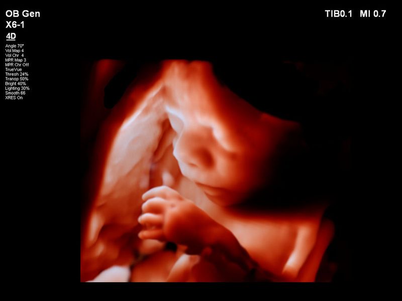 Die optimale sonographische Darstellung des Ungeborenen ist aber auch eine entscheidende Voraussetzung für die Beurteilung der intrauterinen Entwicklung. (Philips)