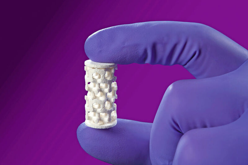 Aus einer speziellen Keramik entsteht an der Bundesanstald für Materialforschung resorbierbarer Knochenersatz. (Bild: Bundesanstalt für Materialforschung und -prüfung)
