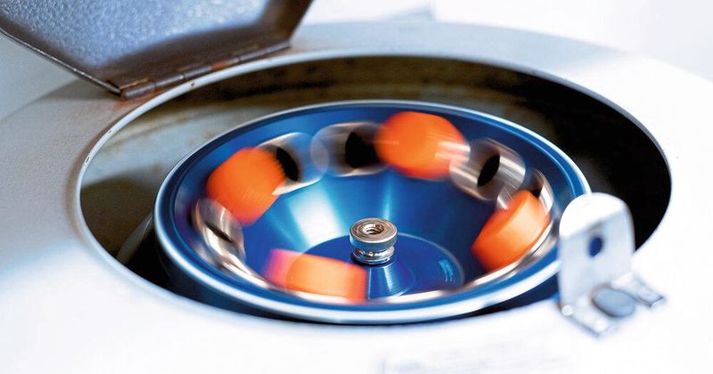 L'automatisation arrive aussi dans les laboratoires notamment grâce à l'intégration des minimoteurs Faulhaber dans les installations de diagnostic. (Source : Jia He)