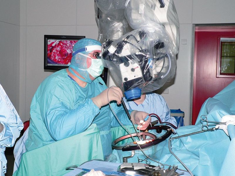 Um eine fluoreszenz-gestützte Tumorresektion durchzuführen, ist ein Operationsmikroskop erforderlich, das mit einer speziellen Lichtquelle und entsprechenden Filtern ausgerüstet ist.  (Bild: Leica)