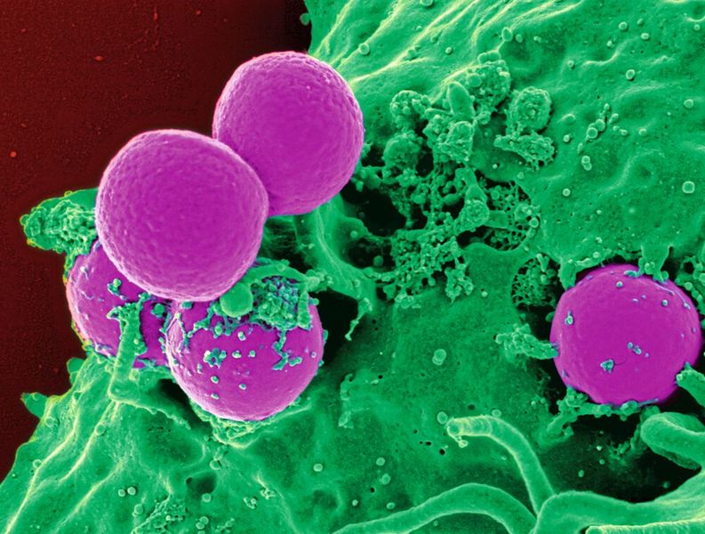 Antibiotika-resistente Bakterien. Kolorierte elektronenmikroskopische Aufnahme. (Bild: CDC/NIAID)