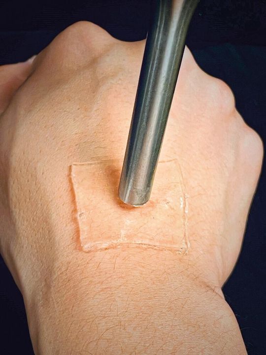 Mit Ultraschall lässt sich das Gelpflaster stark auf der Haut verankern. Mit Ultraschall lässt sich das Gelpflaster stark auf der Haut verankern.